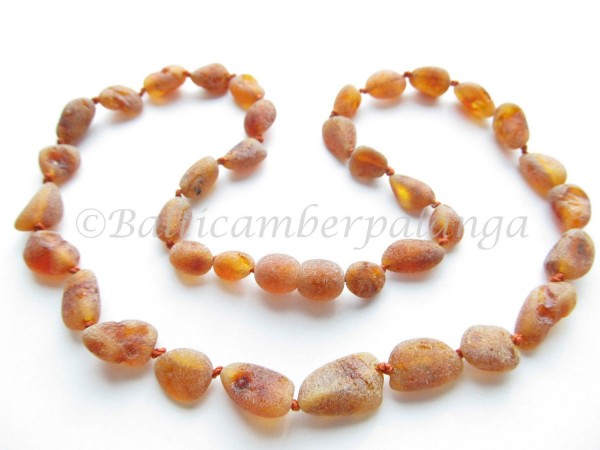 baltic amber necklace